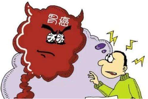 胃癌图片.png